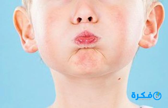ما هو سبب الزغطة وعلاجها للأطفال 1 medium 2019 01 01 bb2d182e19