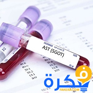ما هو تحليل ناقلة أمين الجلوتامات GOT 1 ASTsgotst