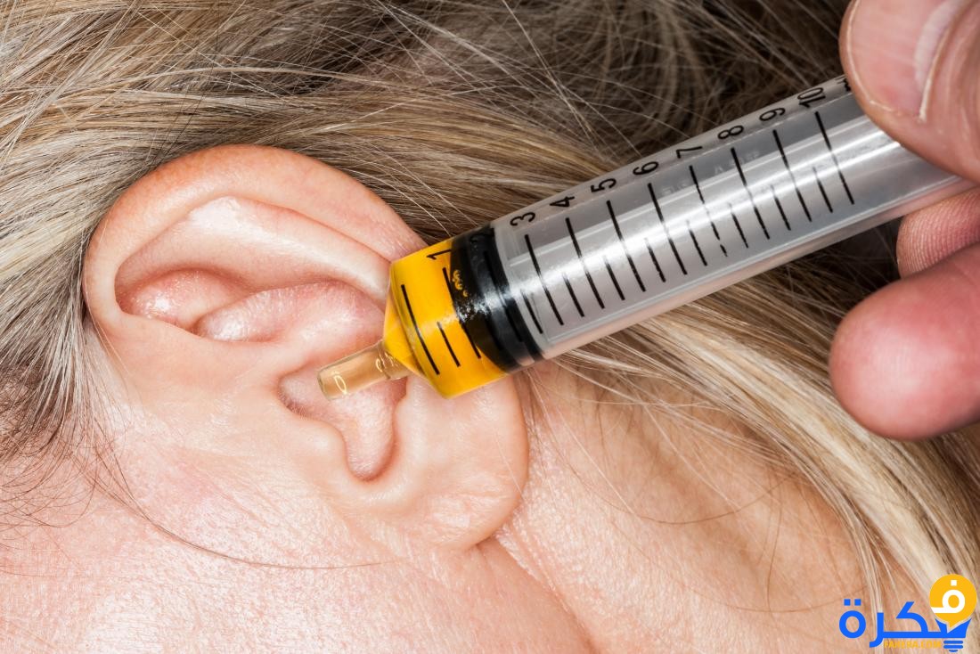 كيف يمكن علاج انسداد قناة استاكيوس ؟ 1 ear drops of oil in syringe being dispensed into clogged ear