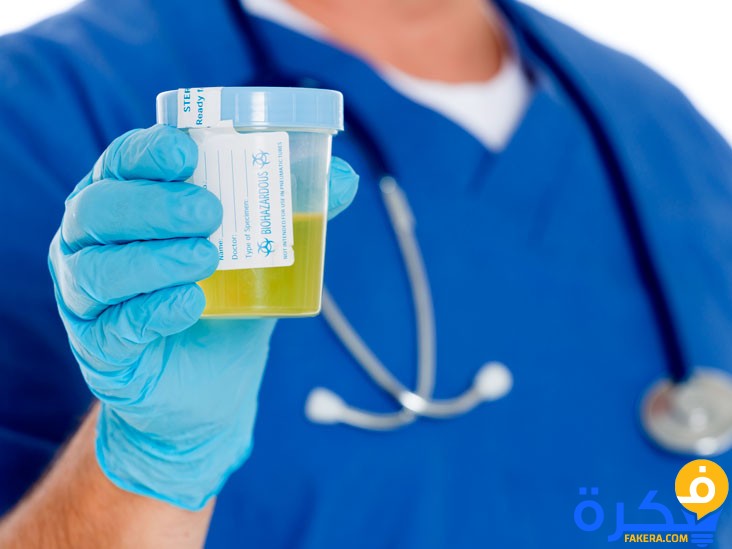 تحليل البول الكامل Complete Urine Analysis 1 glucose test urine thumb