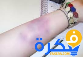 تفسير حلم رؤية الأذى في المنام 1 رؤية الأذى فى المنام