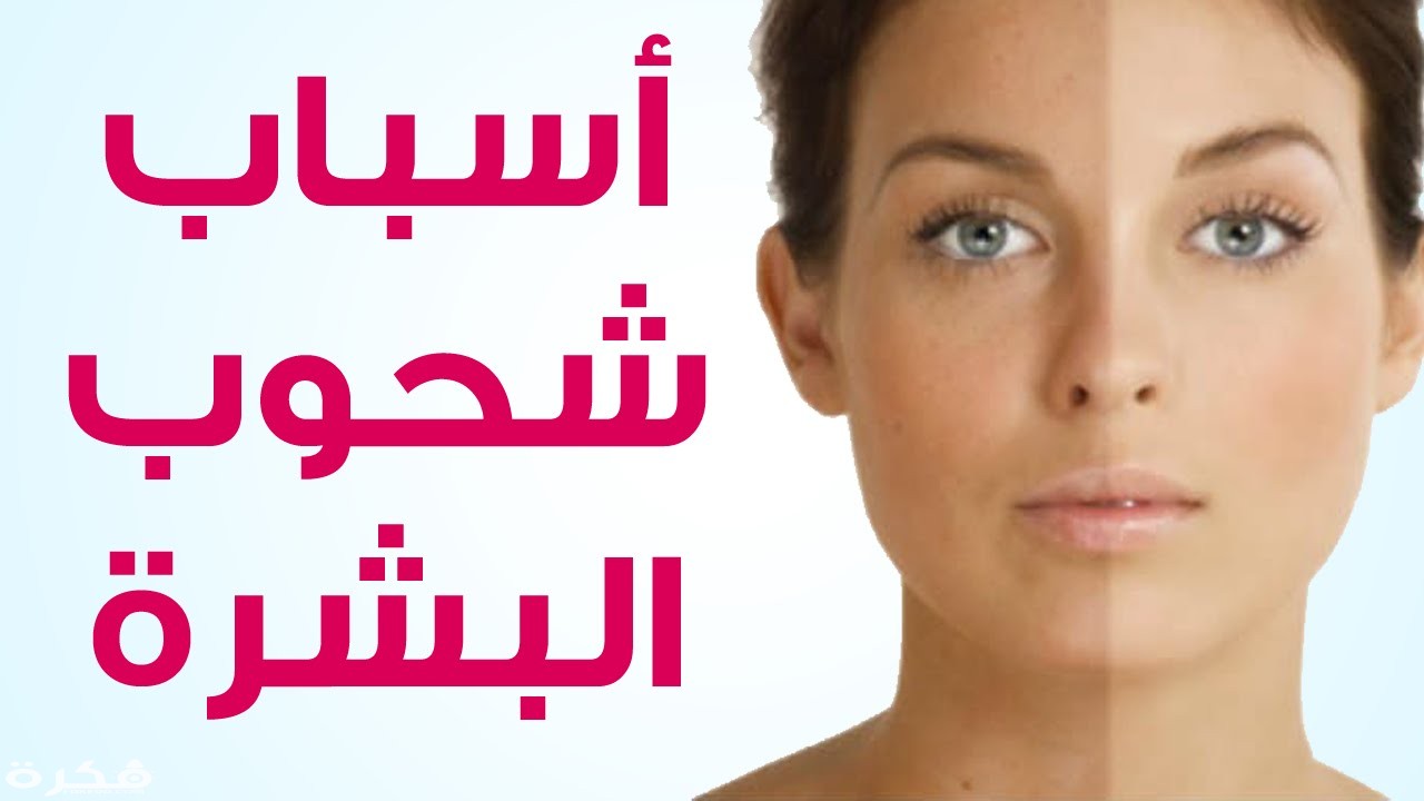 تفسير حلم رؤية شحوب الوجه بالتفصيل 1 3886