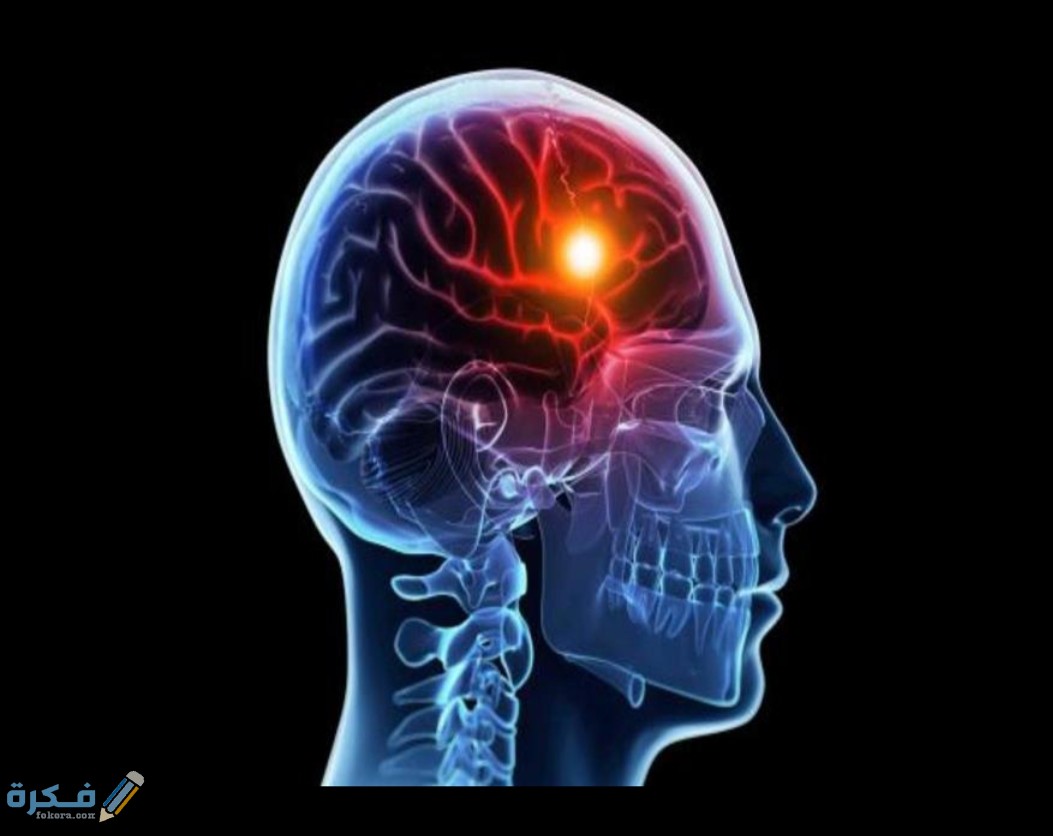 متى يشفى مريض الجلطة الدماغية ؟ 1 IMG ٢٠٢٠٠٥١٧ ٢٣١٤٠٠