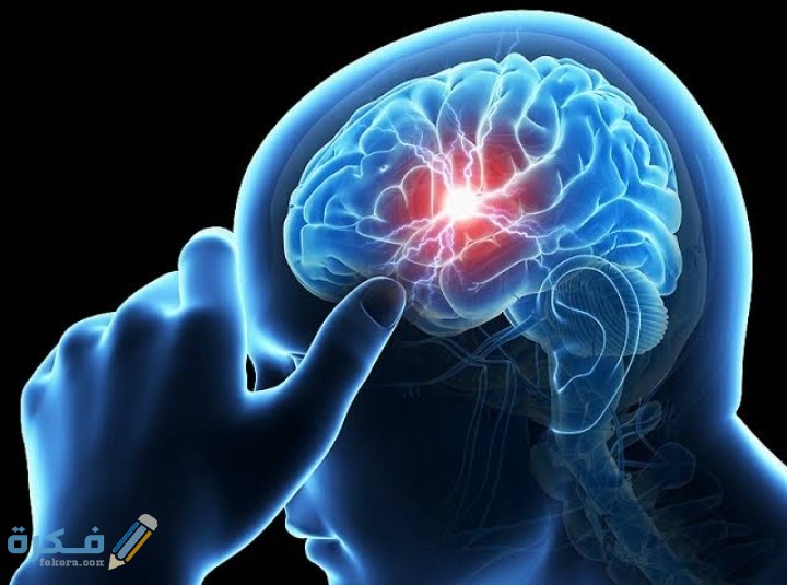 هل نزيف الدماغ يسبب الوفاة والاعراض 1 IMG ٢٠٢٠٠٨١١ ٢٣١٧٢٩