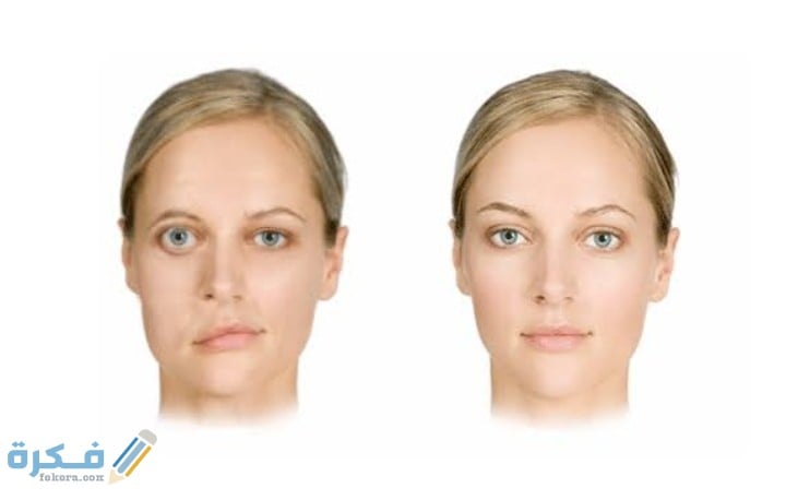 اعراض التهاب العصب السابع بالوجع البسيط وعلاجه 1 IMG ٢٠٢٠٠٨١٢ ١١٤٨٤٤