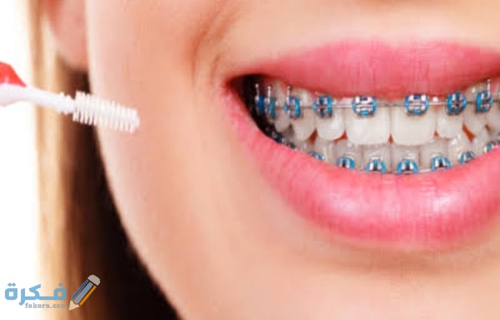 أسعار تقويم الأسنان في مصر 2025 1 IMG ٢٠٢٠١٠٠٢ ٠٧١٥٣٦