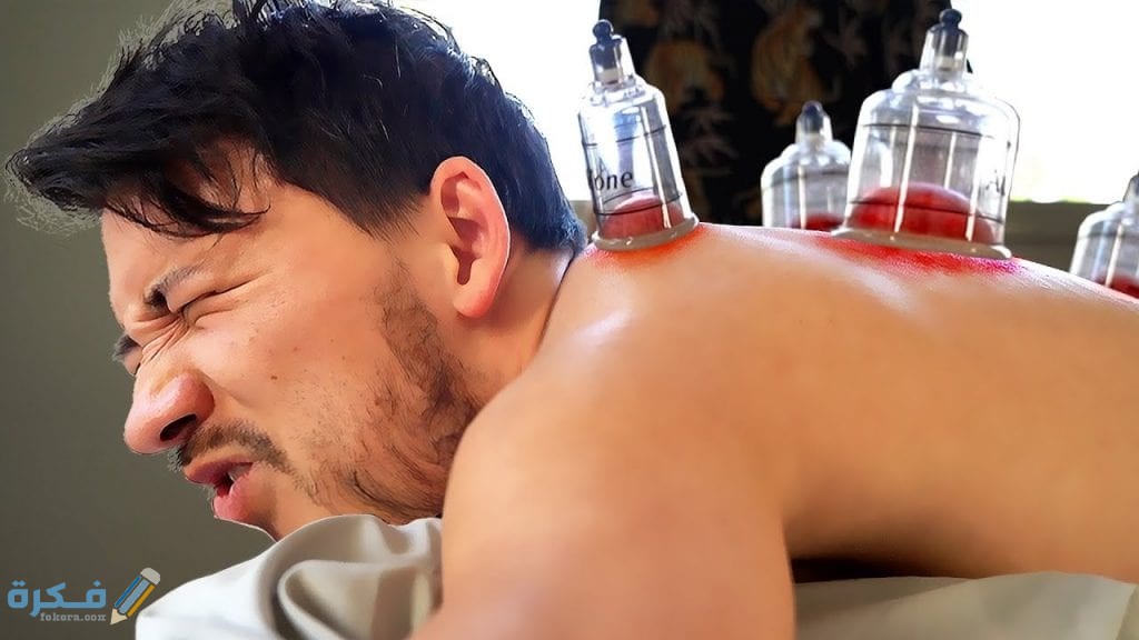 ما هي علامات خروج السحر مع الحجامة 1 خروج السحر مع الحجامة