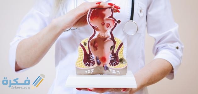 ما هو احسن مرهم لعلاج البواسير الخارجية ؟ 1 ما هو أفضل مرهم لعلاج البواسير الخارجية ؟