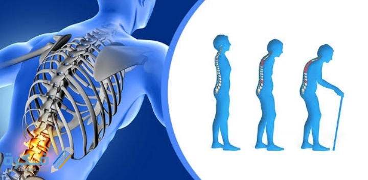 اذاعة مدرسية عن هشاشة العظام 1 IMG ٢٠٢٠١٢٠٤ ٠١٠٥٣١