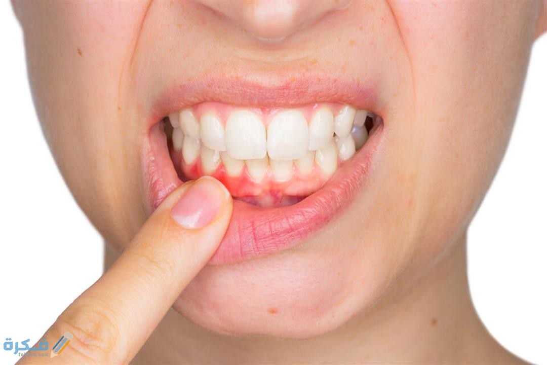 تجربتي مع دواء سيبازول فورت Spirazole forte لعلاج خراج الاسنان 1 2019 11 20 14 57 34 245