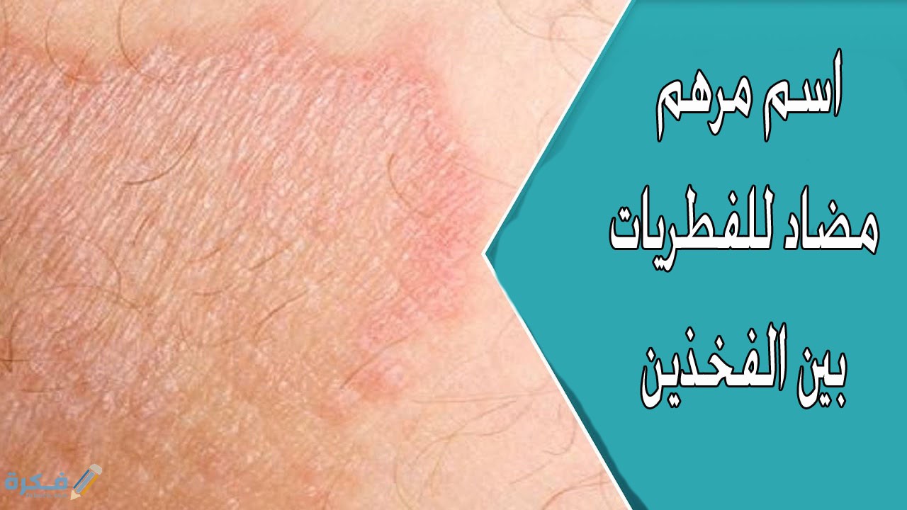 احسن اسماء مرهم مضاد للفطريات بين الفخذين 1 كريم بيتاديرم والتسلخات