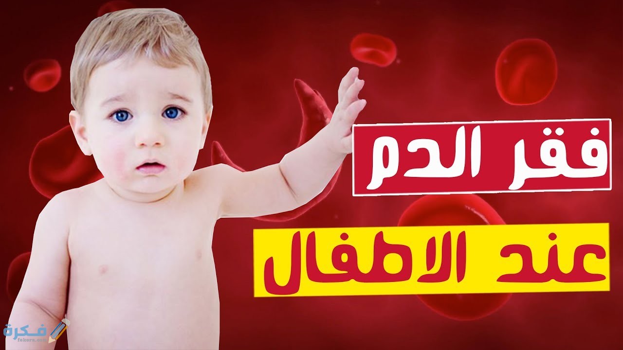 اسم احسن دواء لعلاج الأنيميا عند الأطفال 1 مفهوم الانيميا او فقر الدم عند الاطفال