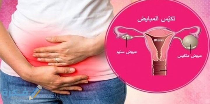 رجيم تكيس المبايض تجارب لمدة 7 أيام 1 IMG ٢٠٢١٠٢١٥ ٠٠١١١٣