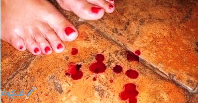 اسماء حقن لوقف نزيف الدورة الشهرية وشرح خطوات علاج النزيف الحاد 1 طرق علاج النزيف الحاد