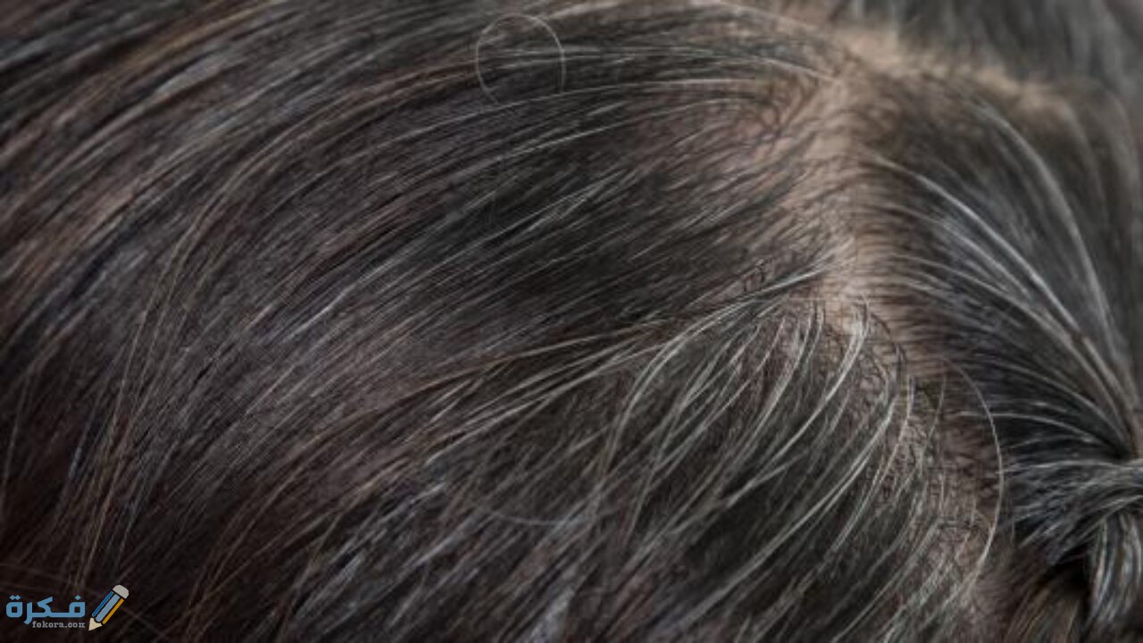 كيف تموت بصيلات الشعر ؟ وسبب موتها وشرح خطوات إحيائها مرة اخرى 1 علاج ضعف بصيلات الشعر