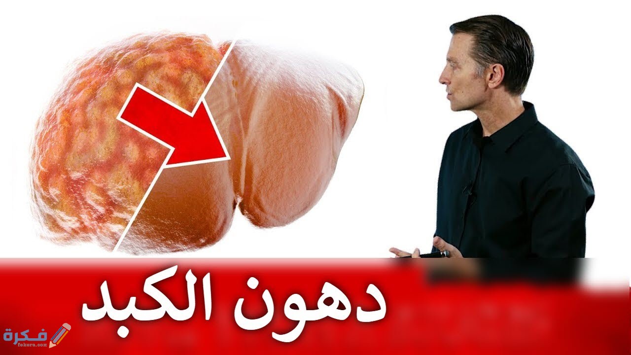 شرح خطوات التخلص من دهون الكبد وأضرارها الصحية 1 اسباب الاصابة بدهون الكبد