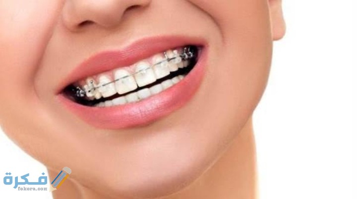 اسعار تقويم الاسنان فى الاسكندرية 1 IMG ٢٠٢١٠٥٢٠ ١٩٠٣١٠