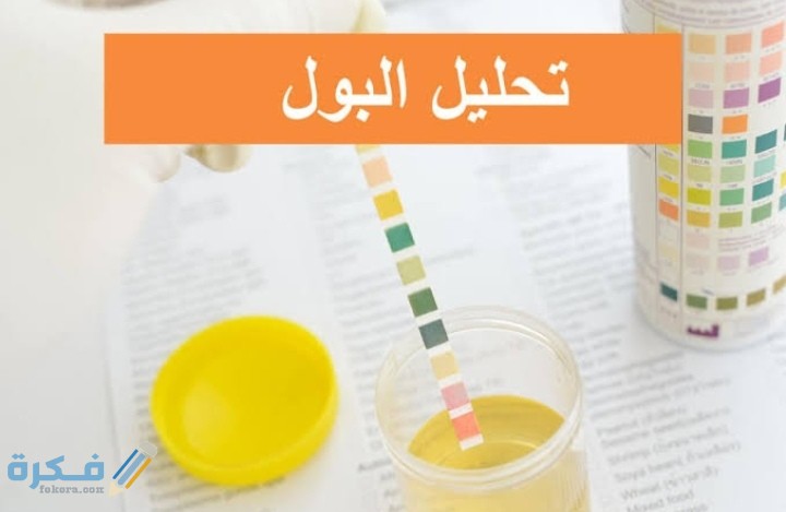 رموز تحليل البول كاملة بالصور شرح الرموز والجدول الكامل 1 IMG ٢٠٢١٠٥٢٧ ٠٧٢٩٣١
