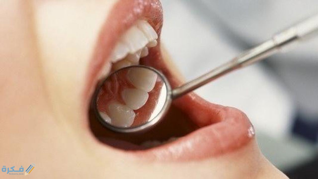 شرح خطوات التخلص من خراج الاسنان 1 اسباب ظهور خراج الاسنان