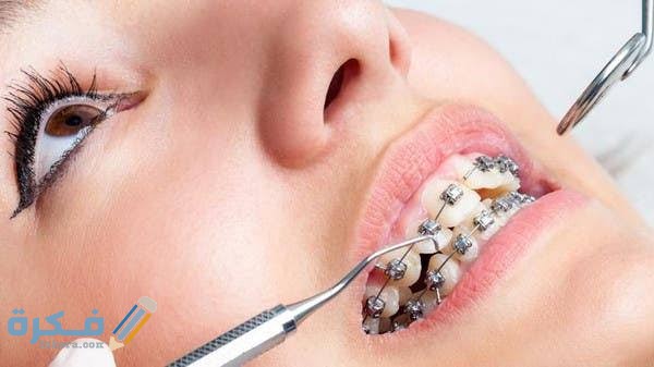 أسعار تقويم الأسنان بالجنيه المصري 1 images 2021 05 19T233829.667