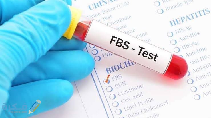 ما هو تحليل FBS وشرح خطوات تفسير نتائج تحليل سكر الصائم وقراءته 1 images 5
