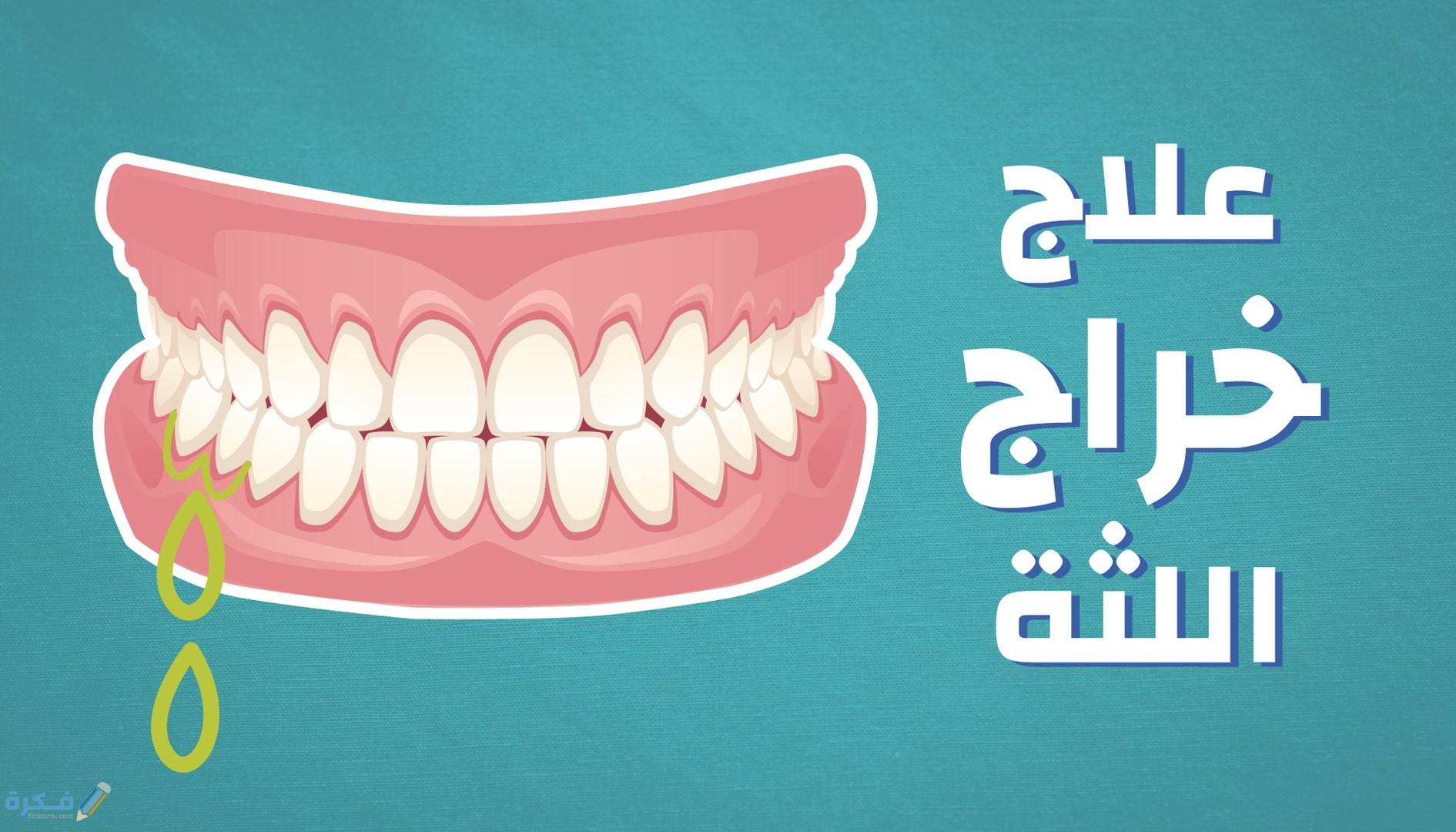 شرح خطوات التخلص من خراج اللثه 1 نصائح للتخفيف من الم الخراج