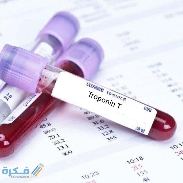 ما معنى gra في تحليل الدم 1 chto takoe troponin norma osnovnie pokazateli i ih rasshifrovka 6