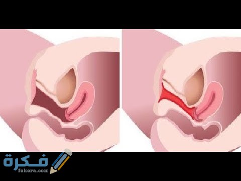 أسماء كريمات تضييق المهبل في الصيدلية 1 DD400C08 0C1F 4F38 81A6 A1229C0B4B32