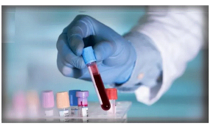 معلومات عن تحليل anti cardiolipin 1 معلومات عن تحليل anti cardiolipin