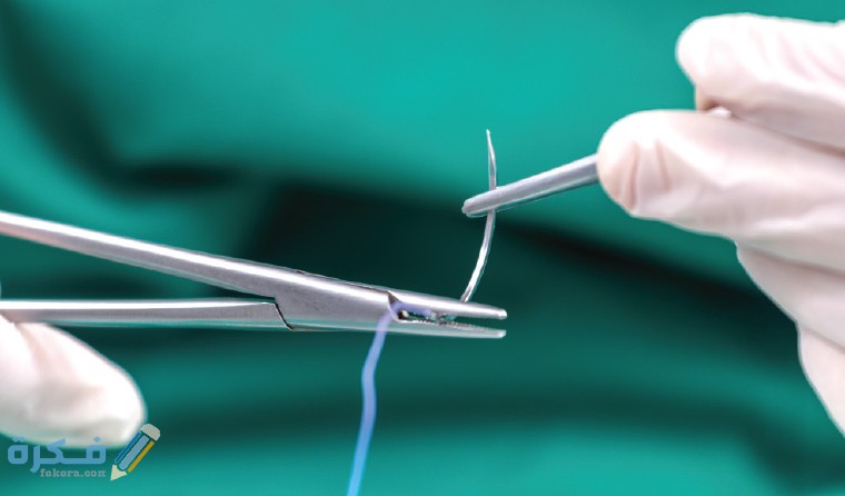 أنواع الخيوط الجراحية واسمائها 1 AJGP 09 2019 Focus Turner Surgical Management Acute Lacerations Feature