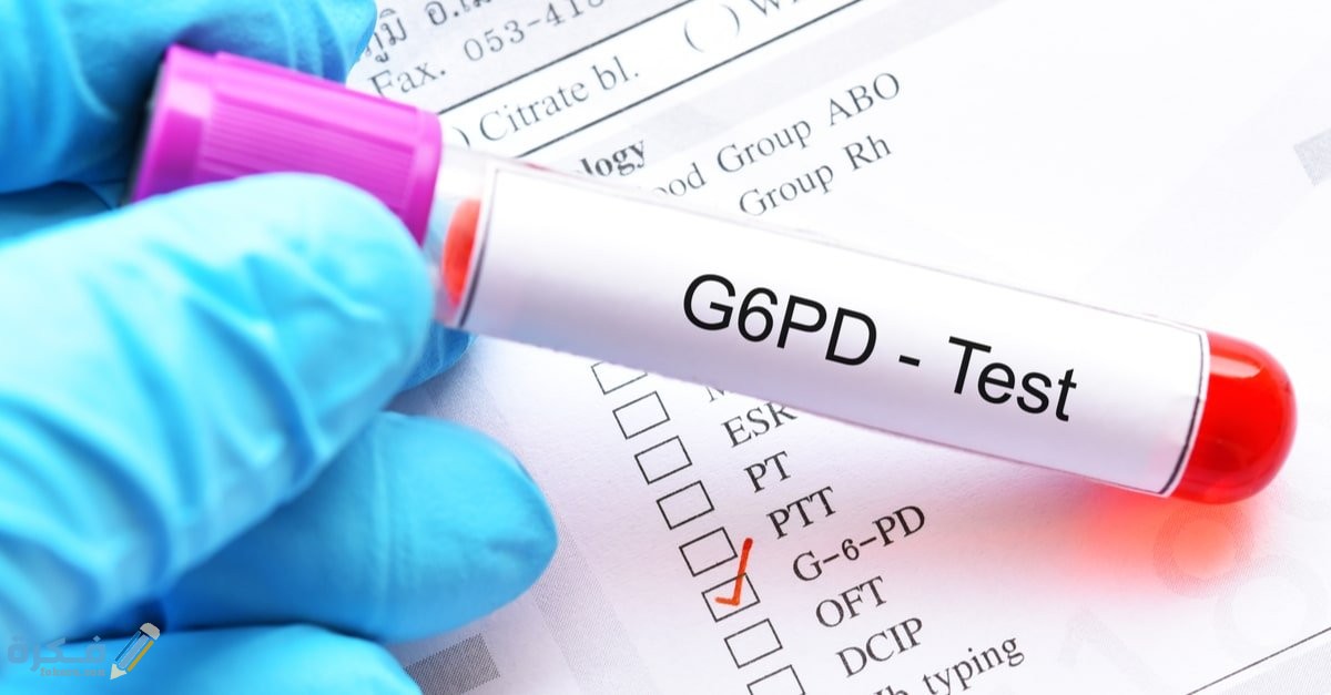 تحليل أنيميا الفول G6PD 1 ygugoghhavb81 article