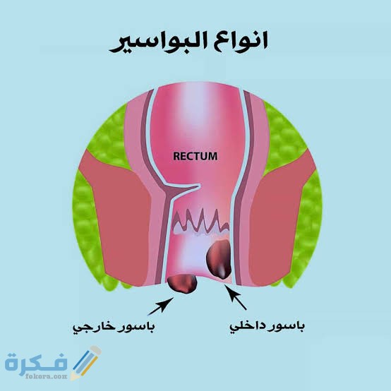 ما هو شكل البواسير 1 images 2022 01 12T215552.295