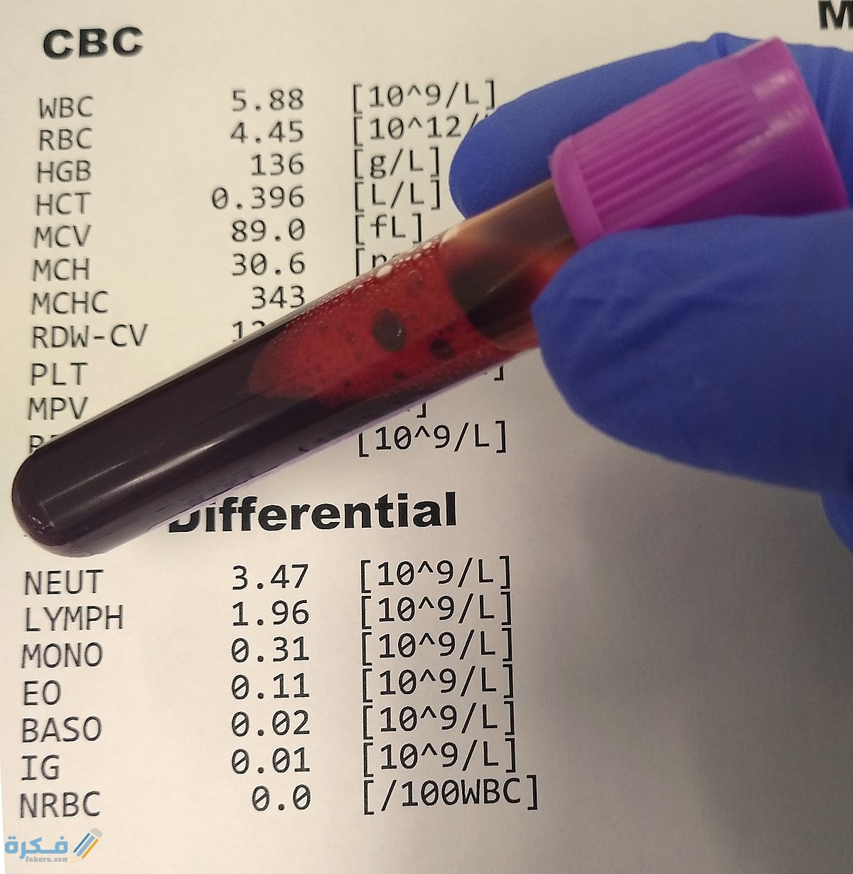 هل يظهر الحمل في تحليل cbc 1 1200px Complete blood count and differential