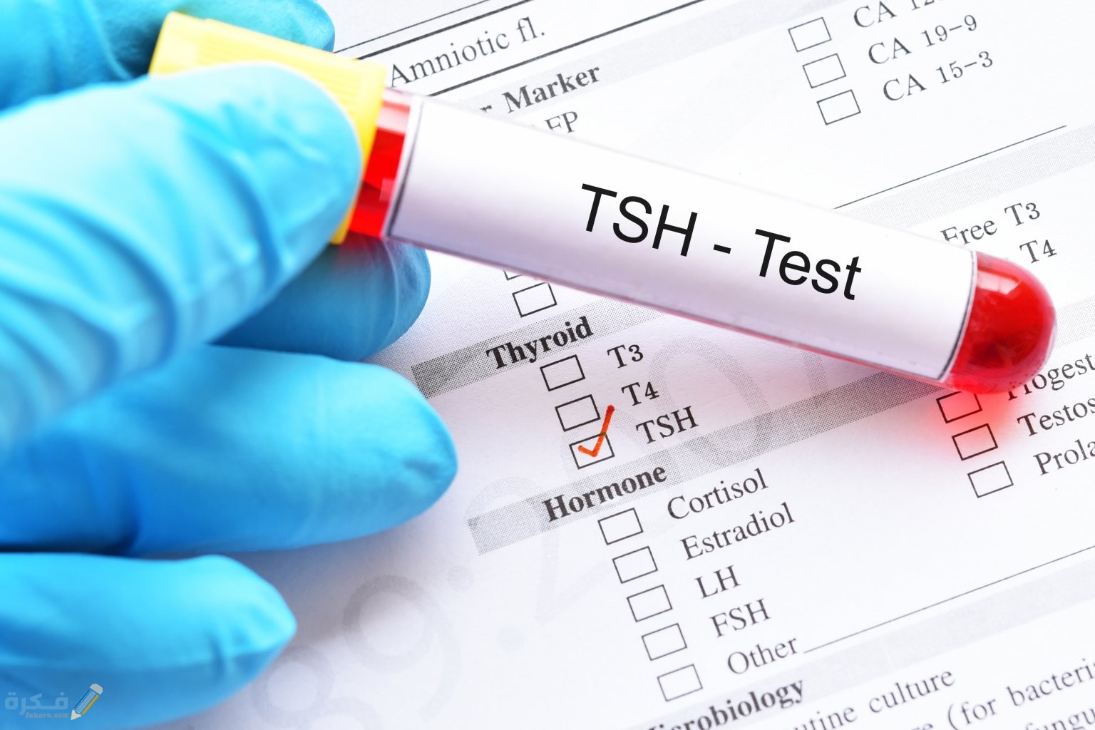 النسبة الطبيعية للغدة الدرقية هرمون tsh 1 ما هي النسبة الطبيعية للغدة الدرقية هرمون tsh