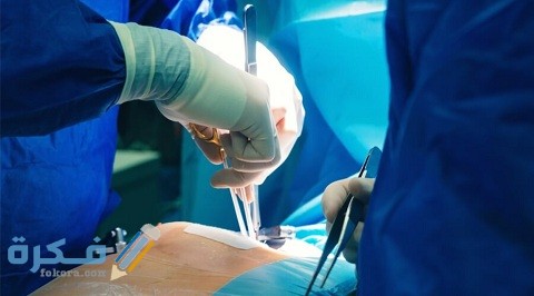 تجربتي مع عملية القلب المفتوح للاطفال ونسبة نجاحها 1 كيف تجرى عملية القلب المفتوح للأطفال