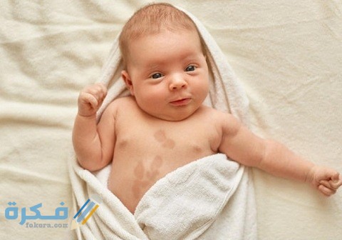 أهم 5 أسباب ظهور بقع بنية على جلد الرضيع 1 ما أسباب ظهور بقع بنية على جلد الرضيع