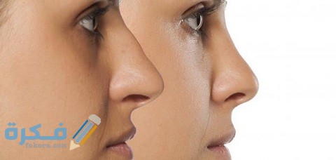هل عملية تجميل الانف حرام ؟ 1 هل عملية تجميل الانف حرام
