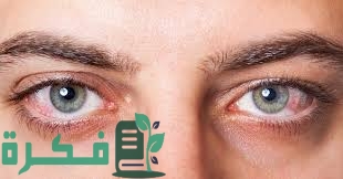 دم في العين بسبب ضربة 1 C7E5DA24 68E7 4277 BF4B FA7151938837