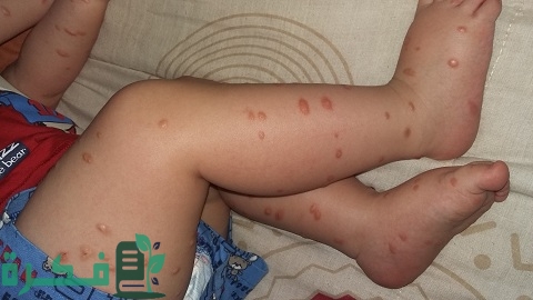 ما هي وظيفة الخلايا البدينة 1 ما هي وظيفة الخلايا البدينة