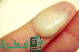 هل افرازات صفراء قبل الدورة من علامات الحمل 1 4BD436A3 A23A 44B1 B6AB 41CA985AF206