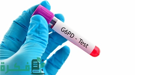 ما هو تحليل أنيميا الفول G6PD 1 ما هو تحليل G6PD