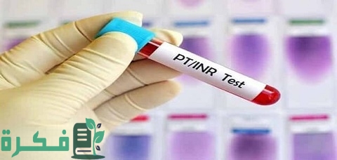 ما هو تحليل INR 1 ما هو تحليل INR