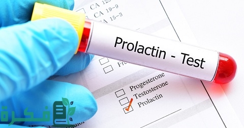 ما هو تحليل Prolactin للرجال 1 ما هو تحليل Prolactin للرجال