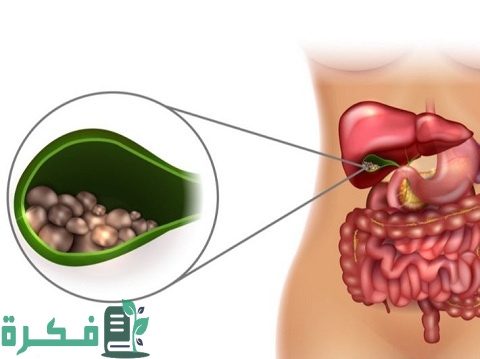 هل يمكن شرب القهوة بعد استئصال المرارة 1 هل يمكن شرب القهوة بعد استئصال المرارة