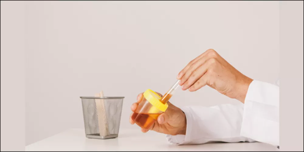 شرح خطوات حساب albumin/creatinine ratio 1 ما هو الألبومين