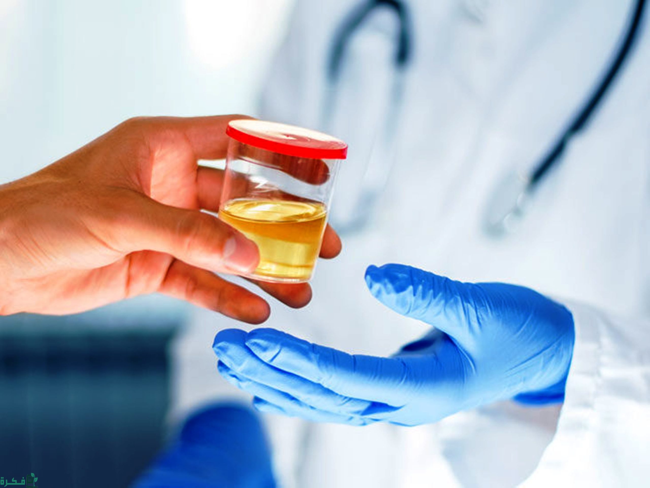 شرح خطوات حساب albumin/creatinine ratio 3 شروط جودة عينة البول للاختبار
