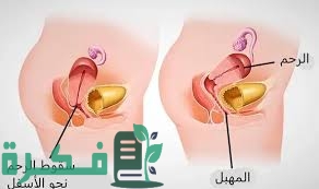 الفرق بين هبوط الرحم وهبوط المثانة 1 D2EDB9D3 460A 4015 B40D D56CCA7C9462