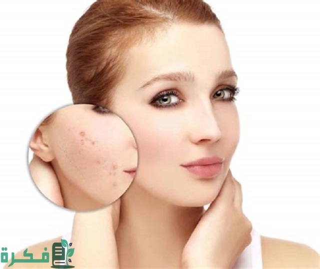 احسن 5 أنواع محلول للحبوب 1 أفضل 5 أنواع محلول للحبوب