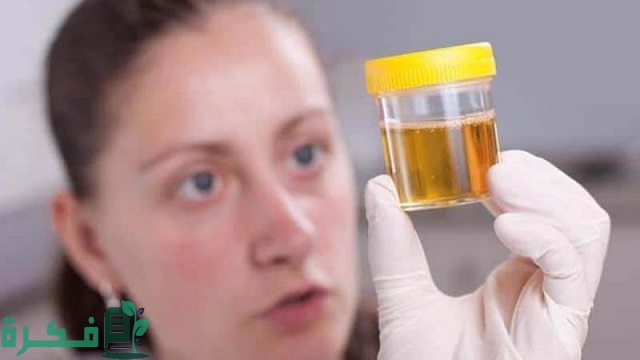 أسماء احسن 5 أنواع مضاد حيوي لعلاج صديد البول 1 أفضل 5 أنواع مضاد حيوي لعلاج صديد البول