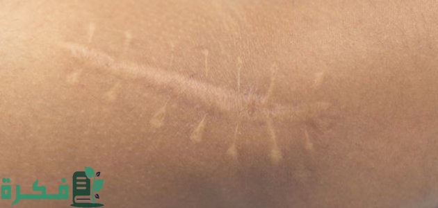 شرح خطوات تكون الأنسجة بالتفصيل 1 كيفية تكون الأنسجة